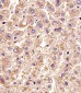 CTSD Antibody